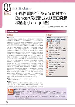 肩・肘の骨折・外傷の手術 (OS NEXUS(電子版付き) 7) [単行本] 岩崎 倫政 肩・肘の骨折・外傷の手術 (OS NEXUS(電子版付き) 7) | 岩崎 倫